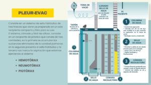 pleur-evac, hemotórax, neumotorax, piotórax